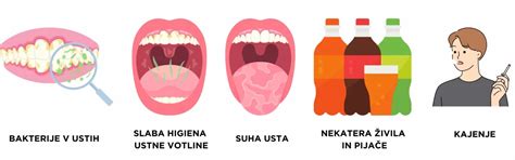 Infografika, ki prikazuje glavne vzroke za ustni zadah pri otrocih: slaba higiena, suha usta, vnetja.
