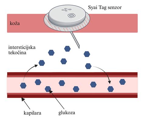 Diagram, ki prikazuje delovanje naprave za neprekinjeno merjenje glukoze (CGM).