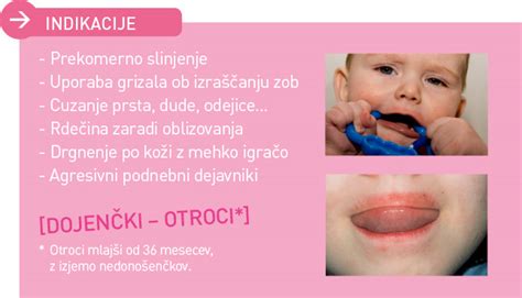 Dojenček z rdečico okoli ust
