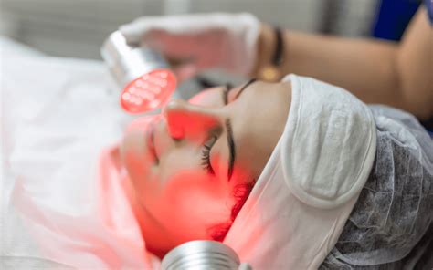 Primerjava kože pred in po terapiji z rdečo svetlobo, ki prikazuje izboljšanje