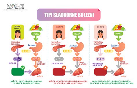 Diagram tipov sladkorne bolezni in njihovih vzrokov