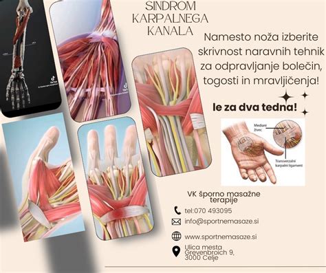 Diagram sindroma karpalnega kanala