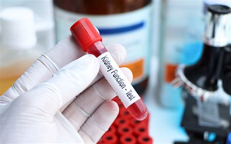 Ženska opravlja krvni test