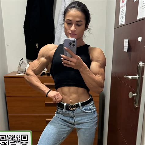 Ženska z oteklimi gležnji