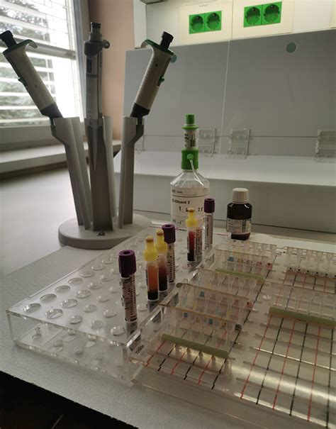 Slika laboratorijske opreme za testiranje krvi