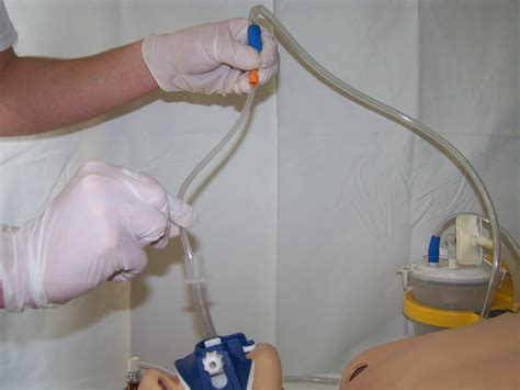 Diagram maternice z označeno vakuumska aspiracija