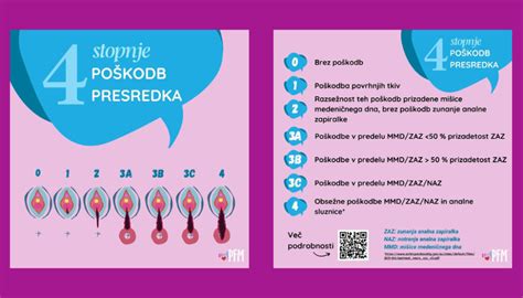 Infografika s priporočili za nego presredka po porodu