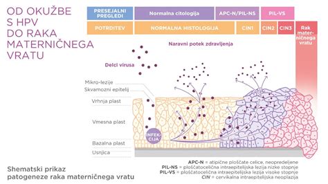 Ilustracija ženskega reproduktivnega sistema s poudarkom na materničnem vratu