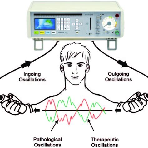 Diagram delovanja bioresonance