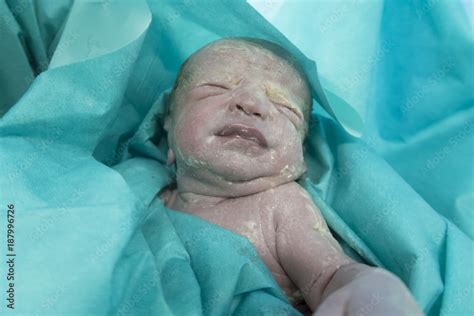 Novorojenček s porodnim mazilom (vernix caseosa) na koži