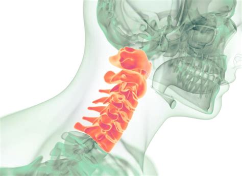 Diagram vratne hrbtenice in mišic