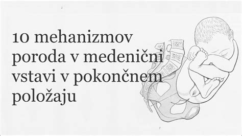 Shema poroda v medenični vstavi