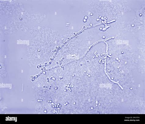 Ilustracija glivice Candida albicans pod mikroskopom