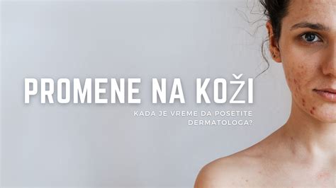 Prizori koprivnice na koži