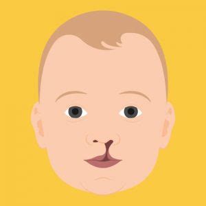 razcep ustnice in neba pri dojenčku