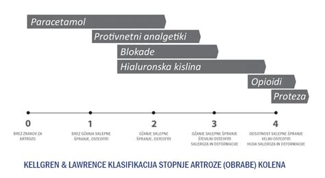 Diagram obrabe sklepnega hrustanca pri artrozi