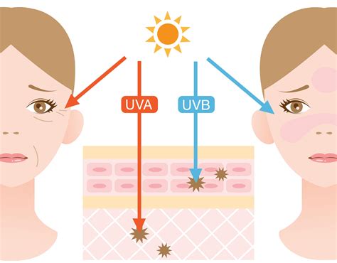 Diagram učinkov UV žarkov na kožo