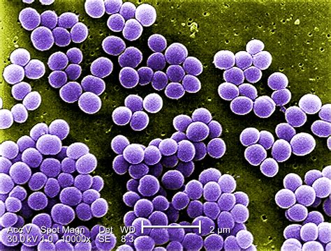Ilustracija bakterije Staphylococcus aureus