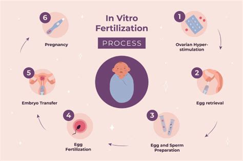 Infografika, ki prikazuje časovnico postopka IVF od prvega posveta do prenosa zarodka.