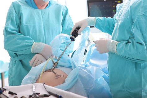 Kirurški rez pri abdominoplastiki