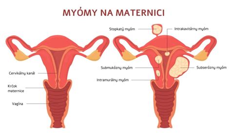 Diagram ženskega reproduktivnega sistema s poudarkom na jajčnikih in maternici